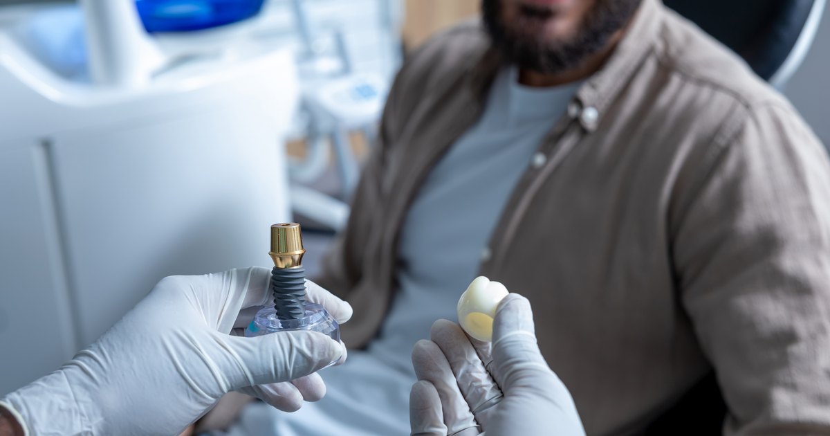 Dentista che mostra un modello di arcata con impianti durante un controllo, All-on-6 impianti a Brindisi